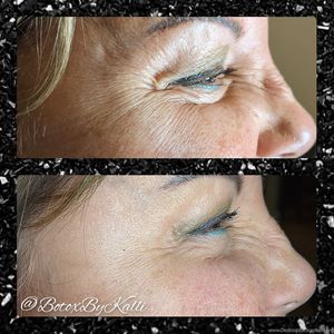 Envy Me Aesthetics photo 34