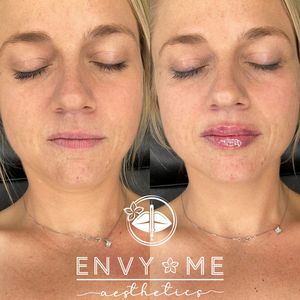 Envy Me Aesthetics photo 35