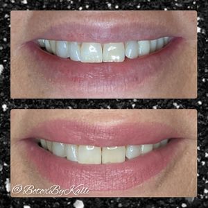 Envy Me Aesthetics photo 36