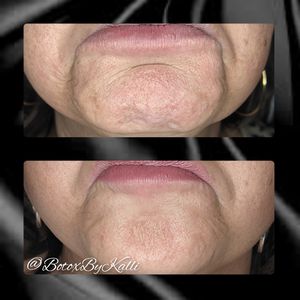 Envy Me Aesthetics photo 37