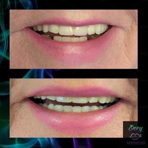 Envy Me Aesthetics photo 38