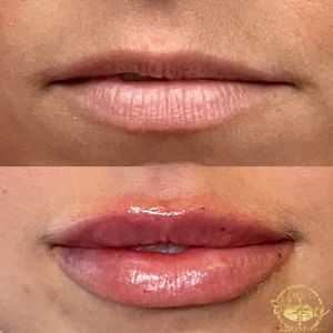 Envy Me Aesthetics photo 41