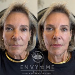 Envy Me Aesthetics photo 42