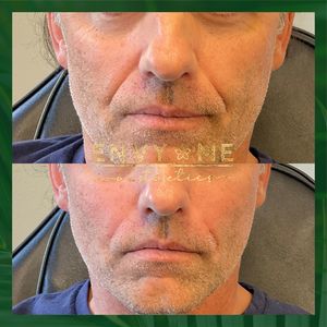 Envy Me Aesthetics photo 44