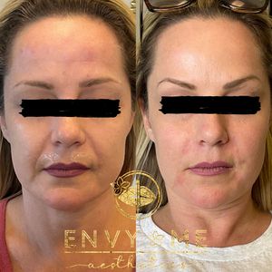 Envy Me Aesthetics photo 48