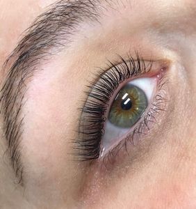 UDERMA MEDSPA & LASER photo 26