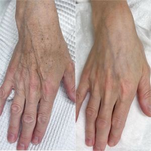 UDERMA MEDSPA & LASER photo 30