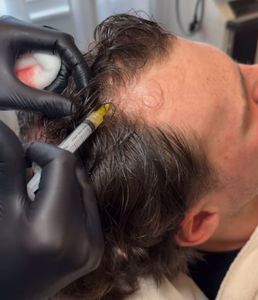 UDERMA MEDSPA & LASER photo 33