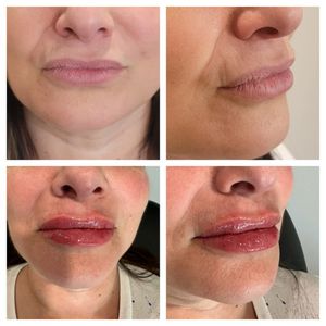 Tranquility Aesthetics and Wellness PLLC photo 30