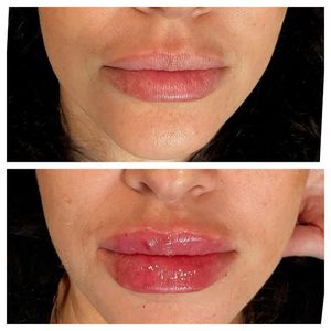 Tranquility Aesthetics and Wellness PLLC photo 32