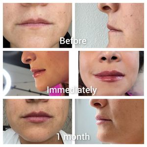 Tranquility Aesthetics and Wellness PLLC photo 33