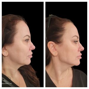 Tranquility Aesthetics and Wellness PLLC photo 34