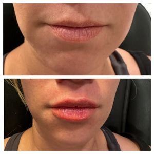 Tranquility Aesthetics and Wellness PLLC photo 36