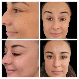 Tranquility Aesthetics and Wellness PLLC photo 38