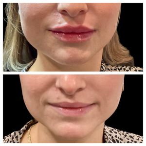 Tranquility Aesthetics and Wellness PLLC photo 40