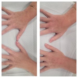 Tranquility Aesthetics and Wellness PLLC photo 43