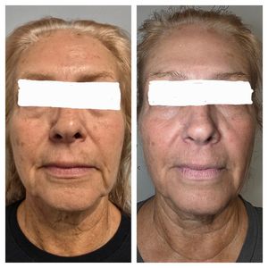 Tranquility Aesthetics and Wellness PLLC photo 46